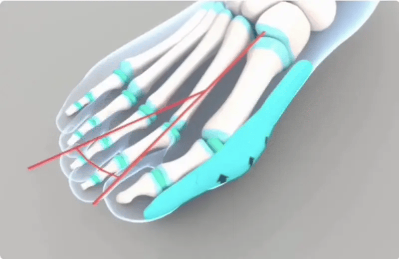 gempages_581627102344774504-8ef05d86-6c79-41f0-83e0-1a35a68b041f.webp__PID:ecf480e1-a7aa-4e22-b349-4f8c3dd7a9a8